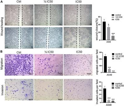 Integrative RNA-Seq and ATAC-Seq Analysis Reveals the Migration-Associated Genes Involved in Antitumor Effects of Herbal Medicine Feiyanning on Lung Cancer Cells